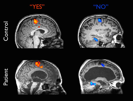 Images from an fMRI  machine