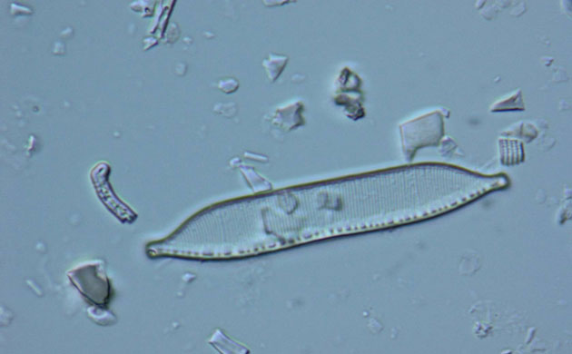 Severn Estuary Wildlife: Sand-dwelling microscopic plant