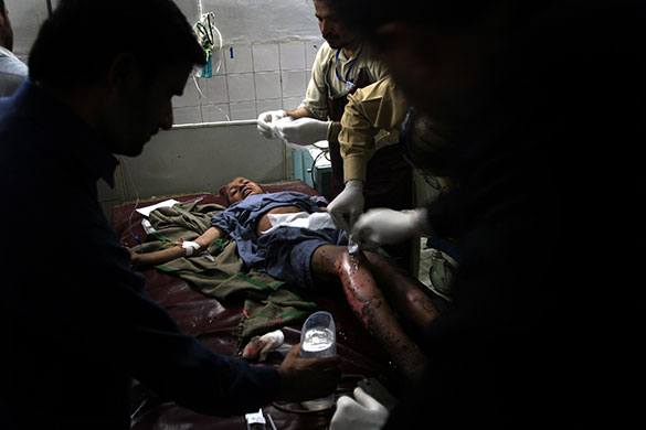 24 hours in pictures: Pakistani hospital staff treat a child injured during a bomb blast