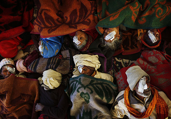 24 hours in pictures: Patients with eye patches Hetauda community eye hospital, Nepal
