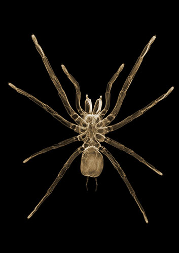 X-ray: A spider