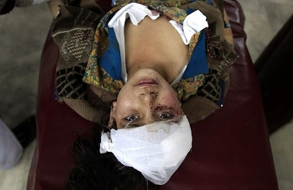 24 Hours in Pics: A girl injured by a suicide bomb blast in Hangu
