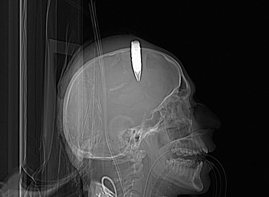 24 Hours in Pics: An incendiary round is removed from an Afghan National Army soldier