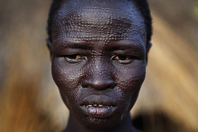 A Sudanese woman with ethnic