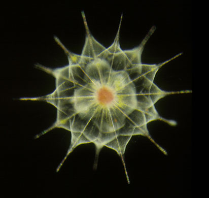 Census Marine Life: Census of Hard-to-See Marine Life : The acantharians