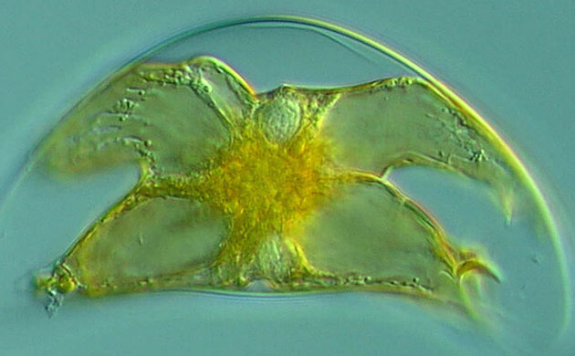 Census Marine Life: Census of Hard-to-See Marine Life : Pyrocystis