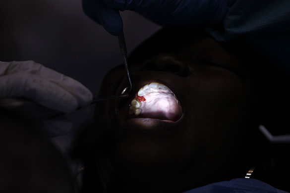 24 hours in pictures: woman has tooth extracted at the Remote Area Medical clinic in Los Angeles