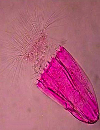 Week in Wildlife: This newfound creature, a loriciferan, lives completely without oxygen