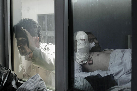 24 hours in pictures: bomb attack victim in afghanistan