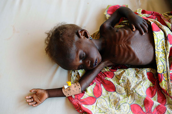 Niger Children: Rahila sleeps in a stablisisation clinic in Aiguie, Niger