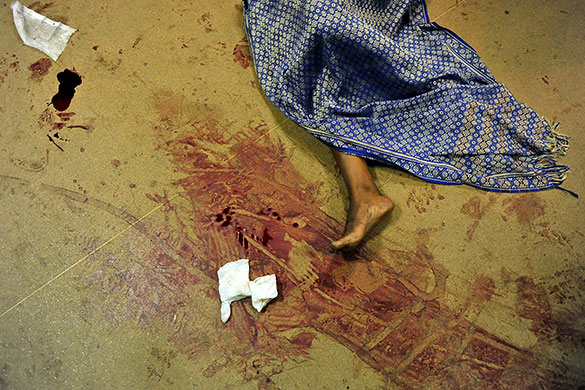 Kenya explosion: An injured victim Kenyatta National Hospital, in Nairobi