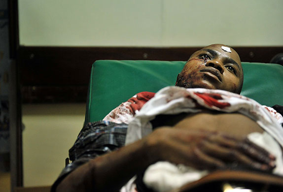 Kenya explosion: An injured victim at the Kenyatta National Hospital