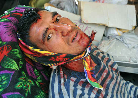 Kyrgyzstan violence: An injured ethnic Uzbek man rests in an Uzbek neighbourhood in Osh 