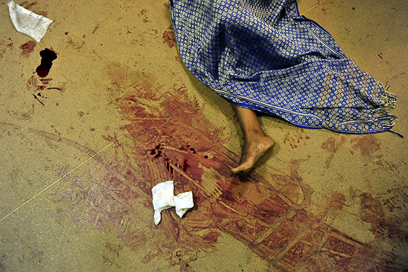 24 hours in pictures: Nairobi: A victim of an explosion at the Kenyatta National Hospital