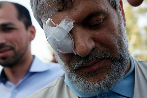Gaza flotilla activists: An Algerian Gaza aid flotilla activist, wearing an eye patch