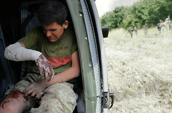 24 hours in pictures: Qandahar, Afghanistan: A wounded Afghan National Army soldier
