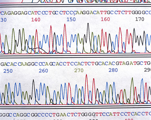 Human Genome Project: A sequencing chromatograph showing a DNA sequence.