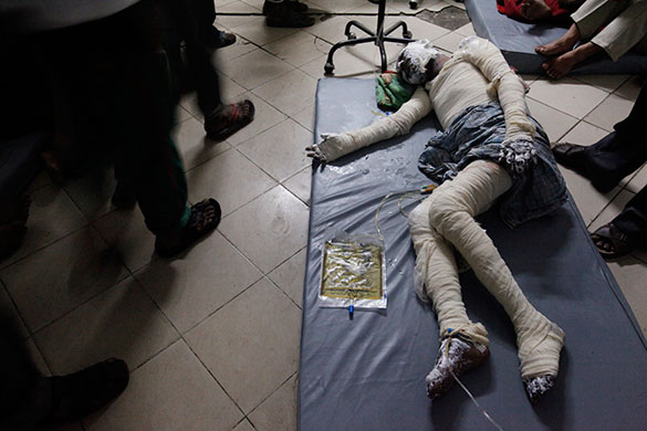 Dhaka fire: Survivor lies on the floor at Medical College Hospital in Dhaka