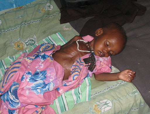 Kids for Kids: A malnourished child lies asleep