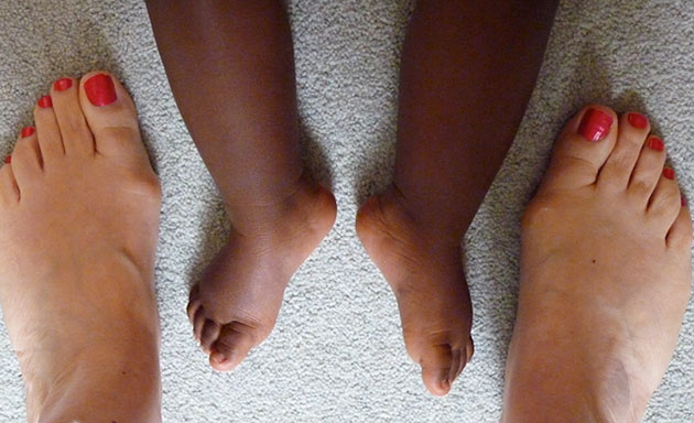 In pictures: Diversity: feet