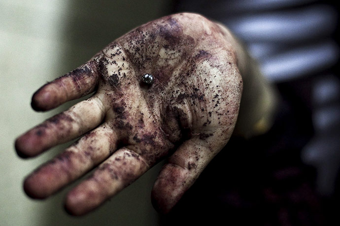 Uganda explosion: Piece of shrapnel removed from his leg at Mulago Hospital, Uganda