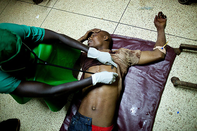 24 hours in pictures: Kampala, Uganda: A doctor treats a victim at Mulago hospital
