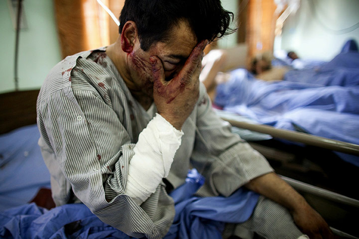 24 hours in pictures: Kabul, Afghanistan: A man waits to receive treatment