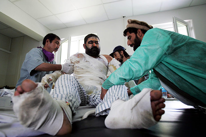 Afghanistan: 6 September 2009: An Afghan victim