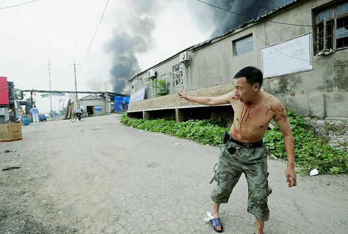 china factory explosion: A wounded man walks from the site of an
