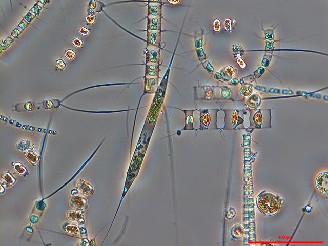 Week in Wildlife: Marine diatom cells which are an important group of phytoplankton
