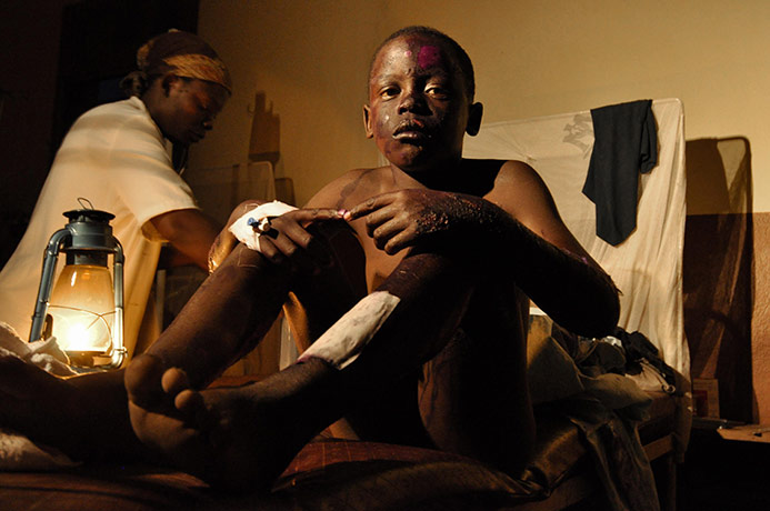 Congo tanker explosion: 10-year-old Olivier Jerrard who survived an oil explosion rests in Sange
