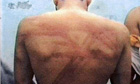 A 2005 photograph released by Iraqi MPs of a man with wounds from alleged torture in an Iraqi prison