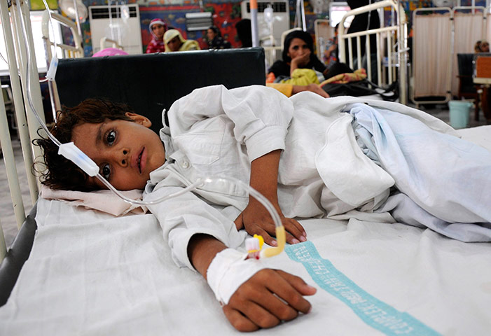 Pakistan Flood Disaster: A Pakistani flood affected child suffering from a waterborne disease