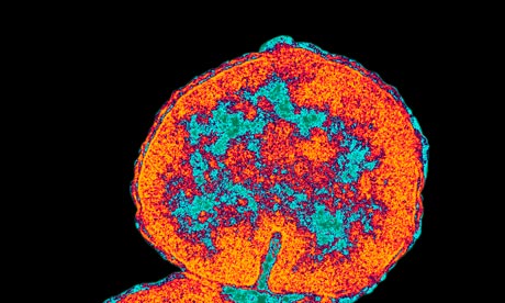 Neisseria gonorrhoeae, the bacteria that causes gonorrhea. 