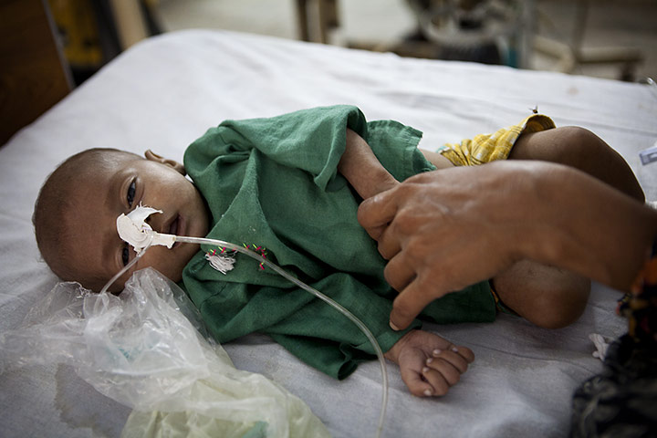 Pakistan Pregnant Women: Muhammad, three-months-old boy is given intravenous antibiotics on a ward