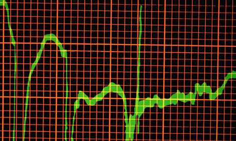 ECG showing heart attack