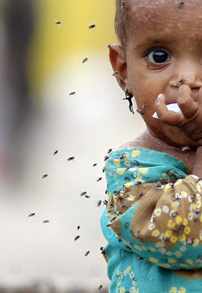 24 hours: Sukkur, Pakistan: Flies fly around a sick girl at a relief camp 