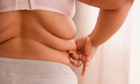 Fat woman obese obesity The obesity crisis will not be solved by exercise 