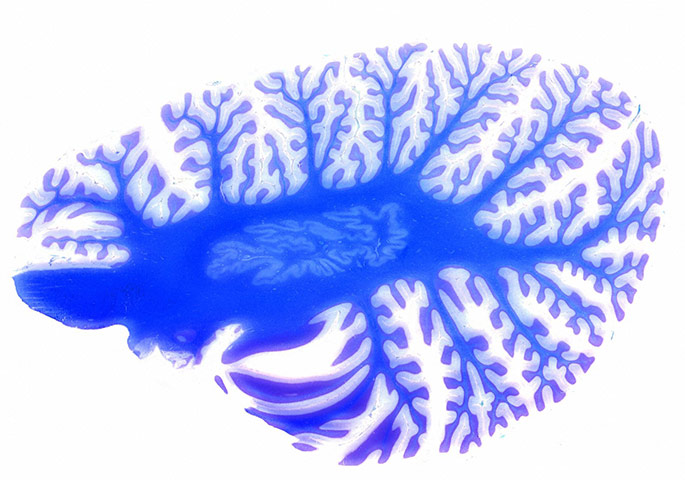 Bike blog: Cerebellum