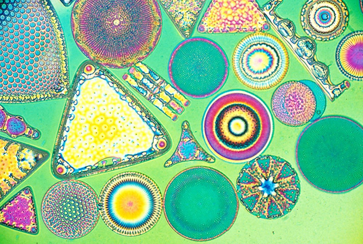 Bike blog: Diatom frustules, polarising microscope