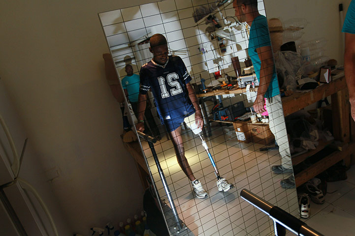 Haiti one year on: January 10, 2011: A man walks for the first time with his prosthetic leg