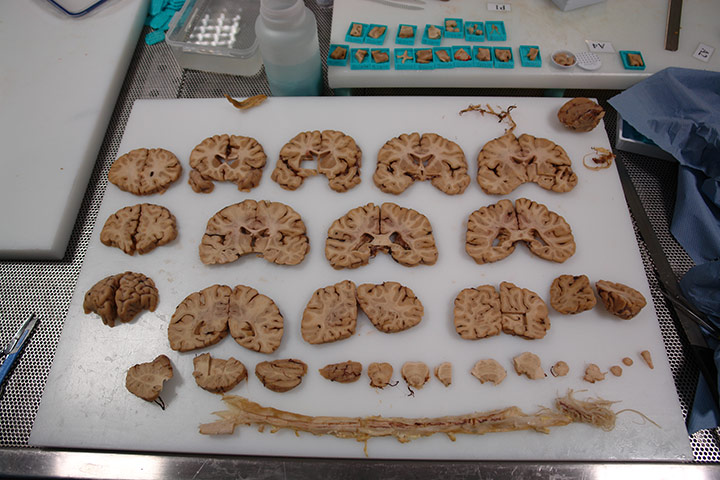 Brainstorm: Investigating the brain through art and science