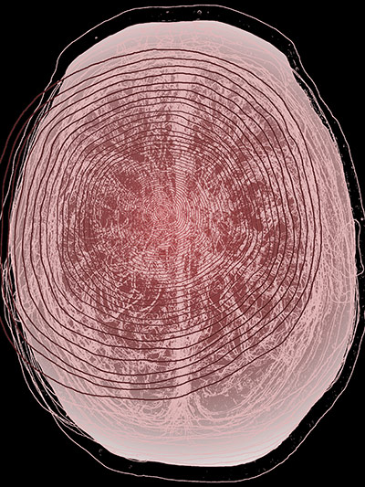 Brainstorm: Investigating the brain through art and science