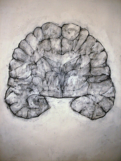 Brainstorm: Investigating the brain through art and science