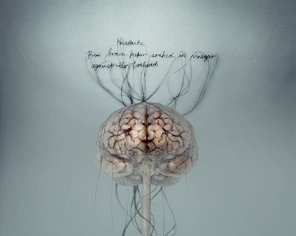 Brainstorm: Investigating the brain through art and science