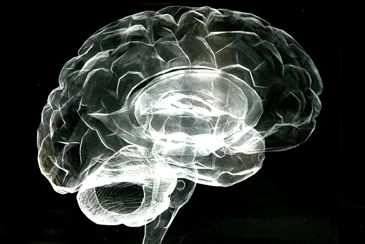 Brainstorm: Investigating the brain through art and science