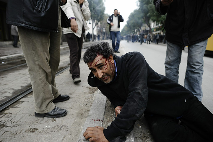 24 hours in pictures: A man lies injuried during a demonstration in tunis