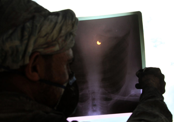 eclipse update: A Lebanese worker looks through a x-ray partial solar eclipse