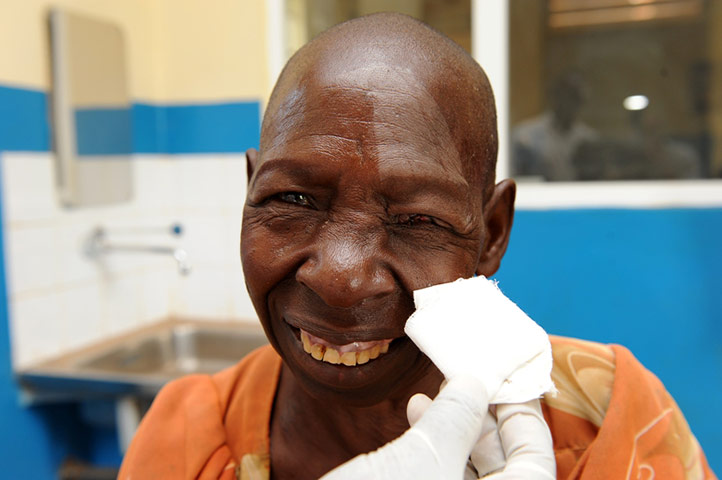 World Sight Day : Spotlight on trachoma