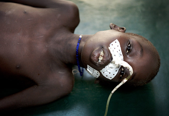 Giles Duley: South Sudan
